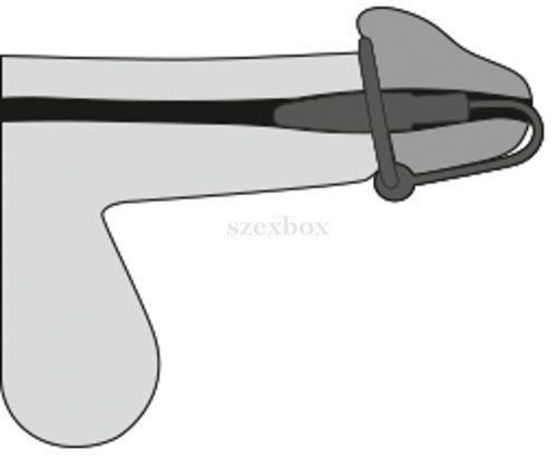 szilikon makkgyűrű húgycsőkúppal